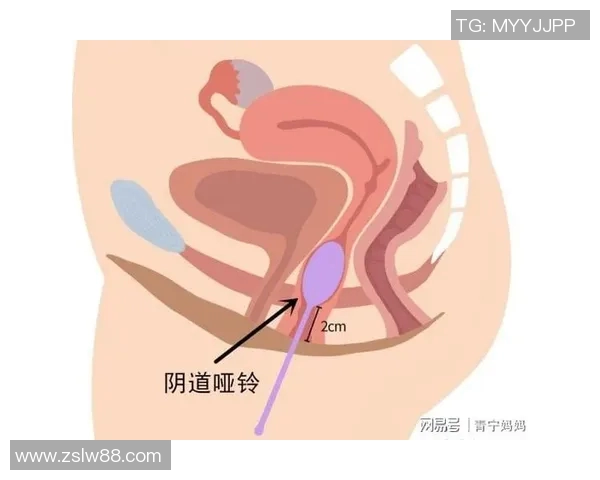 产后修复哑铃原理解析与应用技巧助力女性恢复身材